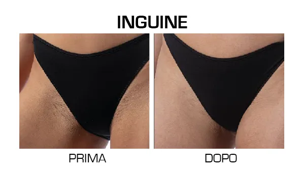 inguine